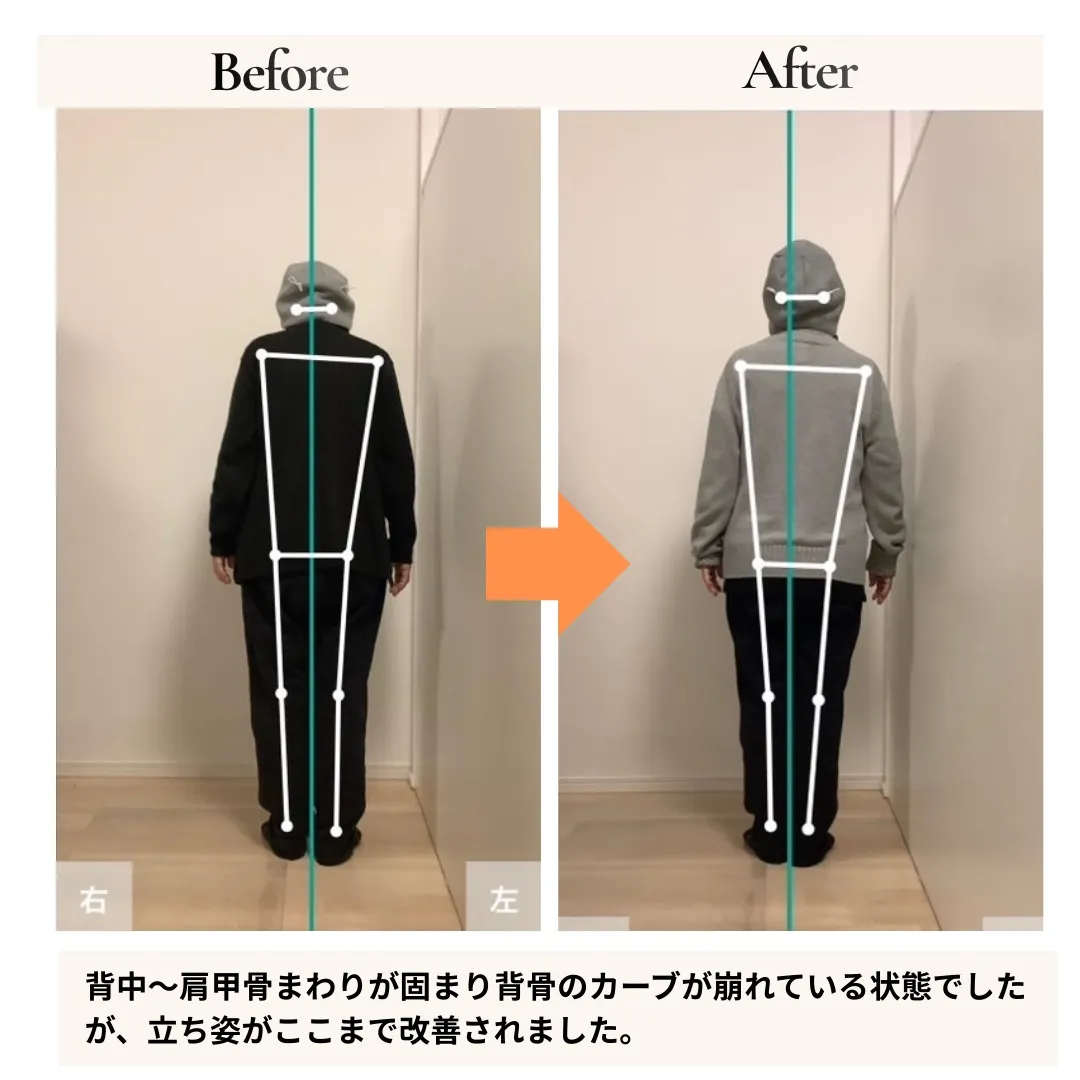腰痛すべり症・変形性膝関節症 背面