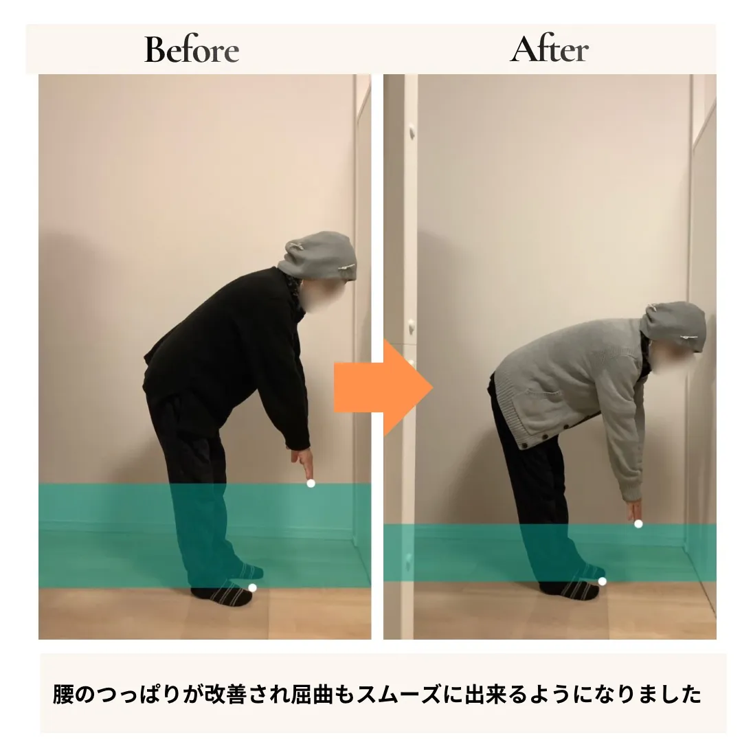 腰痛すべり症・変形性膝関節症 前傾姿勢