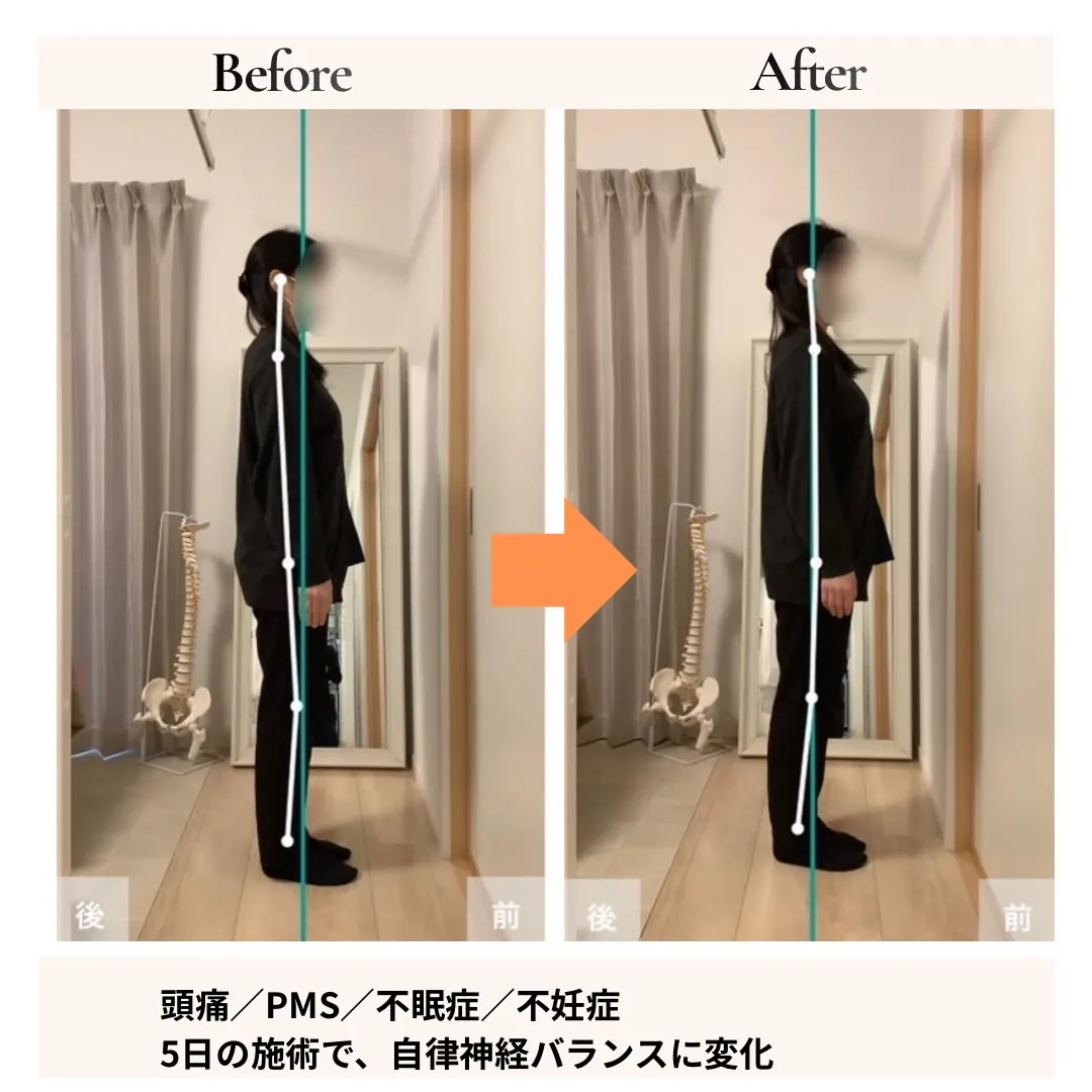 頭痛・PMSの改善事例